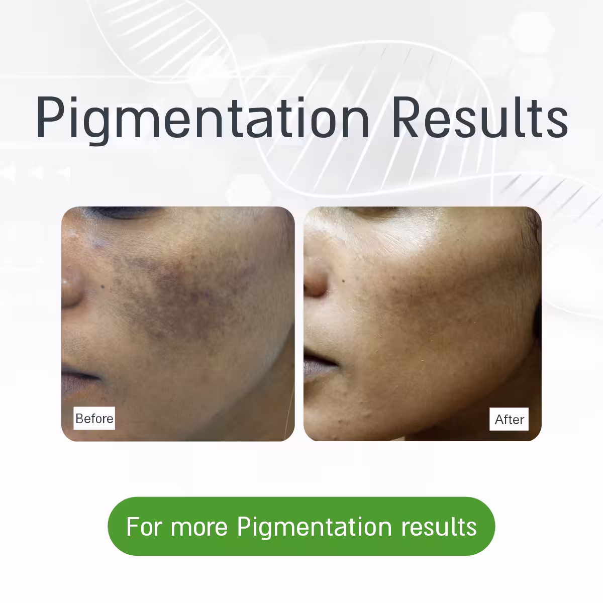 pigmenttation image